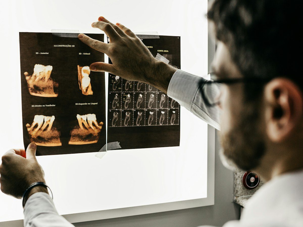 A clinician examining an X-ray of a patient’s feet on a light box.